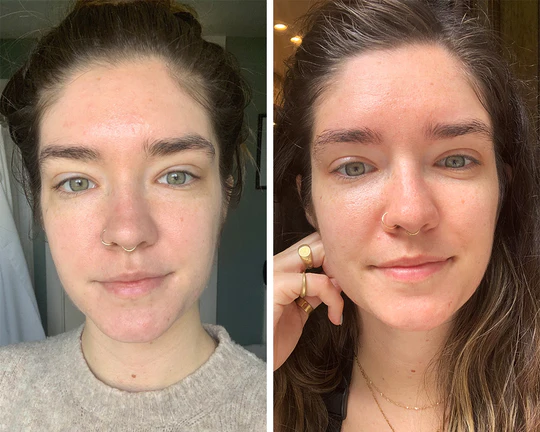 Two side-by-side photos of a woman with light skin and dark hair, showing subtle differences in skin texture and lighting. She is wearing a septum ring and poses in natural light.