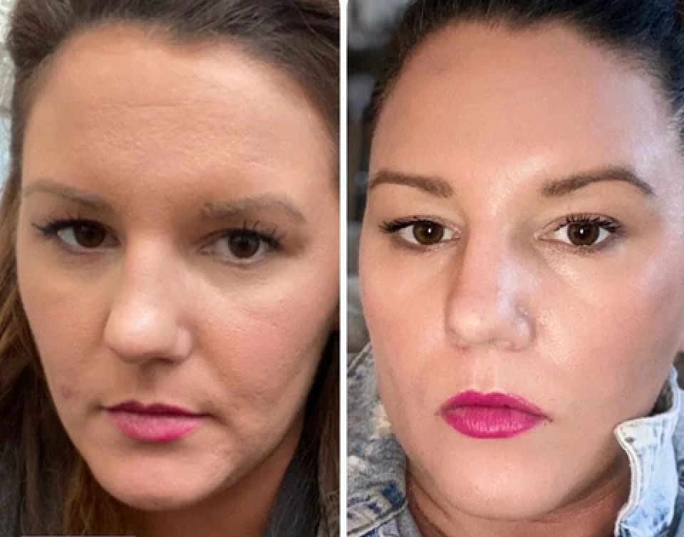 Side-by-side comparison of a woman's face showing subtle skin transformations, with the left image having a more matte appearance and the right image having smoother, glowing skin.