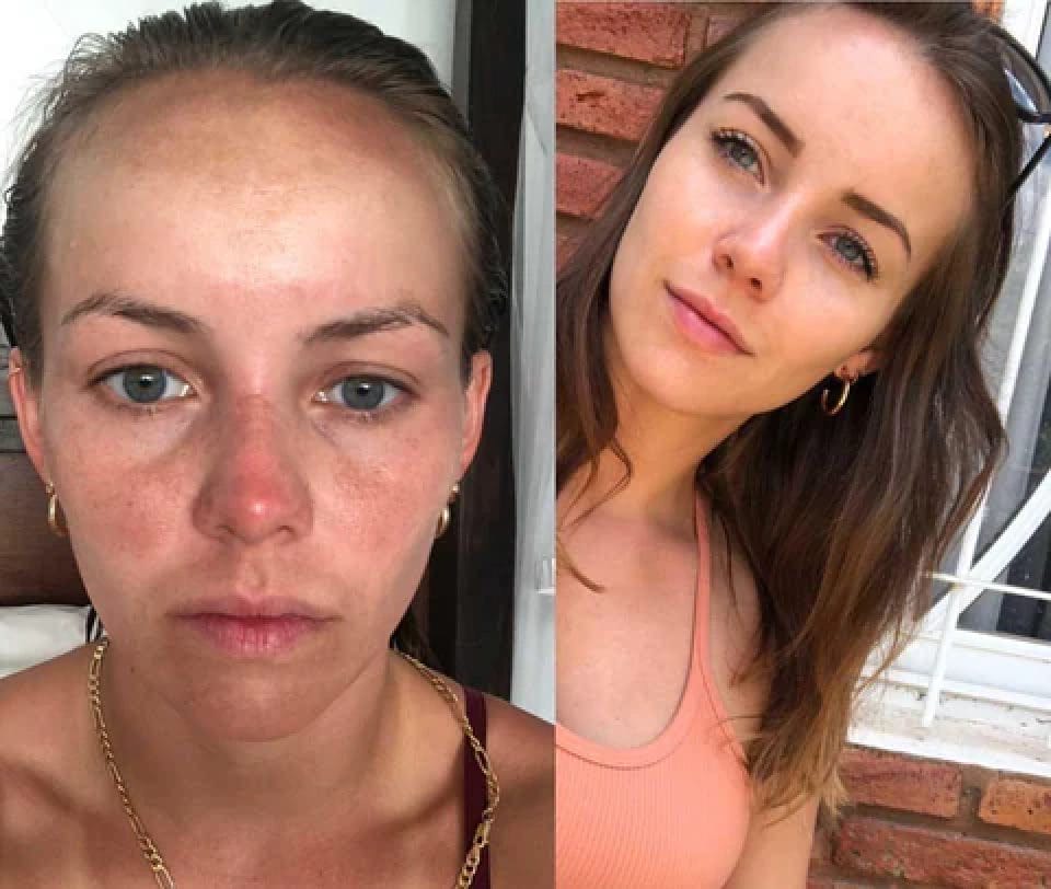 Two close-up photos of the same woman. Left: no makeup, natural lighting. Right: wearing makeup, outdoor setting, smiling slightly.